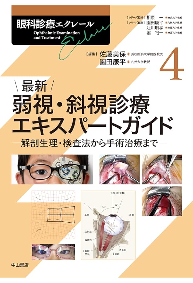 Amazon.co.jp: そこが知りたかった!弱視斜視診療のポイント (新篇眼科